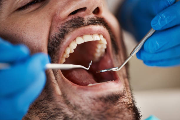 Best Emergency Dental Care for Broken or Chipped Teeth in Muncy, PA